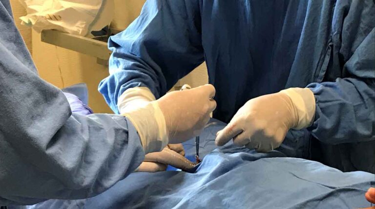 Free No-Scalpel Vasectomies Offered in PV